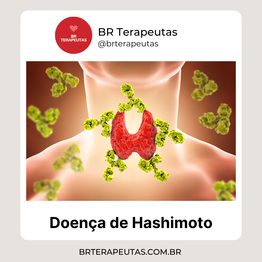 Causa e tratamento da Doença de Hashimoto