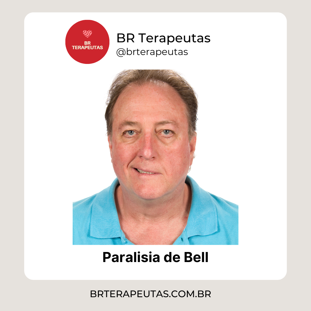 Informações sobre a Paralisia de Bell - foto de um homem com paralisia no músculo facial - BR Terapeutas