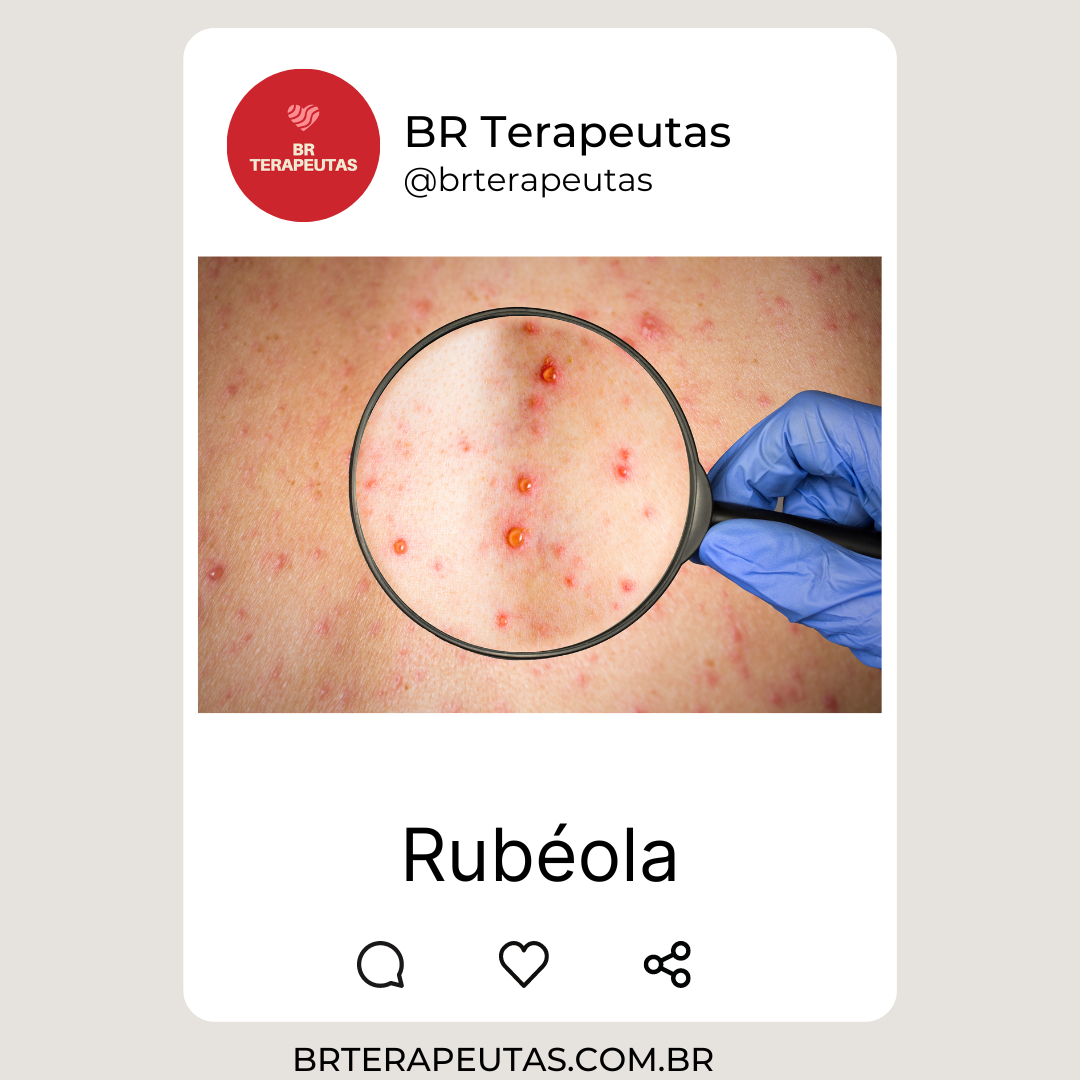 O que é Rubéola?