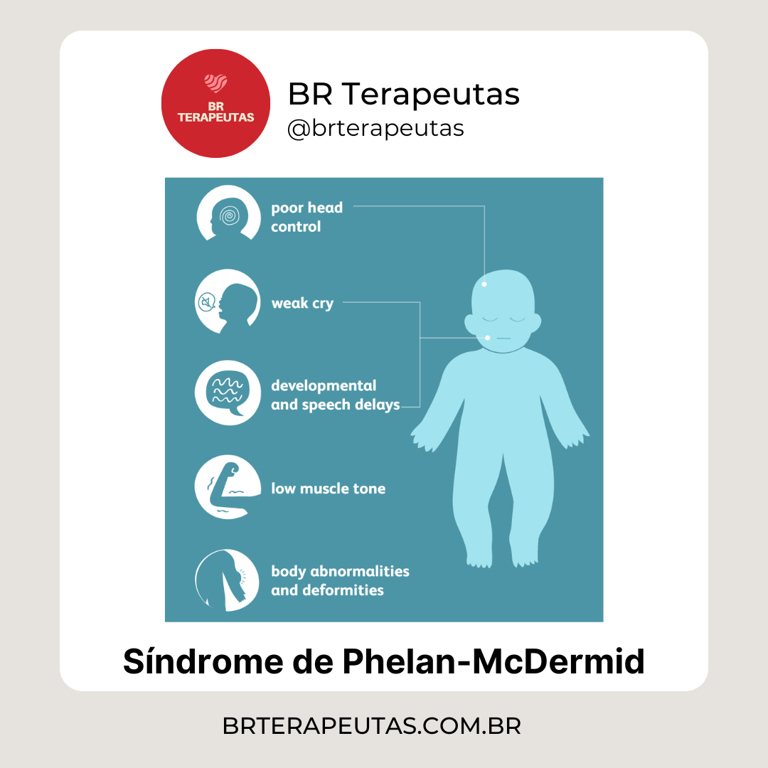 O que é a Síndrome de Phelan-McDermid - foto das caractrístcias da Síndrome de Phelan-McDermid - BR Terapeutas